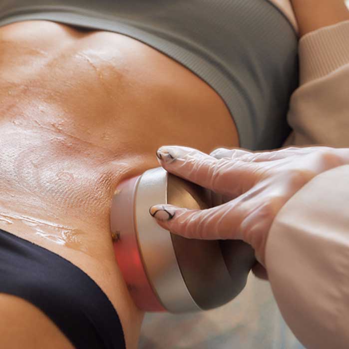 Lipo Laser Therapy in Monroeville, PA