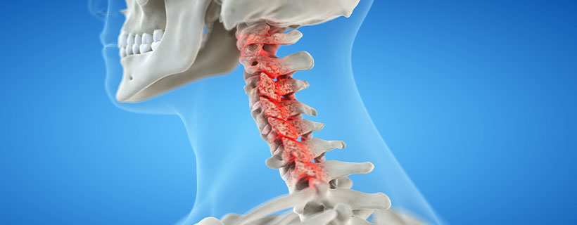 patient needing bone spur treatment in Monroeville
