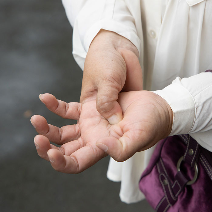 dupuytren contracture chiropractor in Monroeville, PA