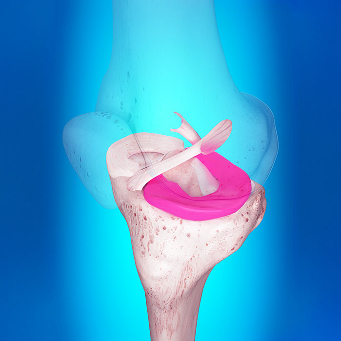 ligamentitis chiropractor in Monroeville, PA
