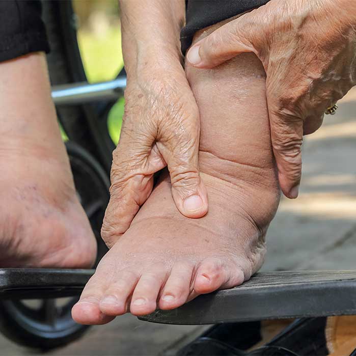 peripheral neuropathy relief in Monroeville, PA
