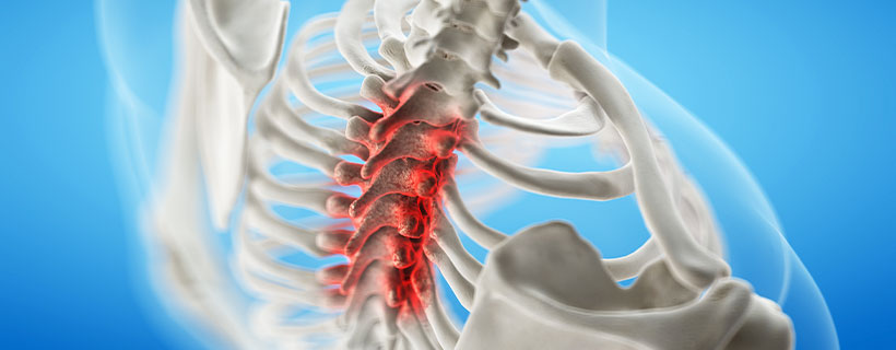 patient needing spinal stenosis treatment in Monroeville